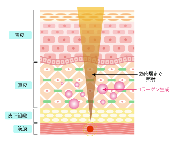 SMAS筋膜