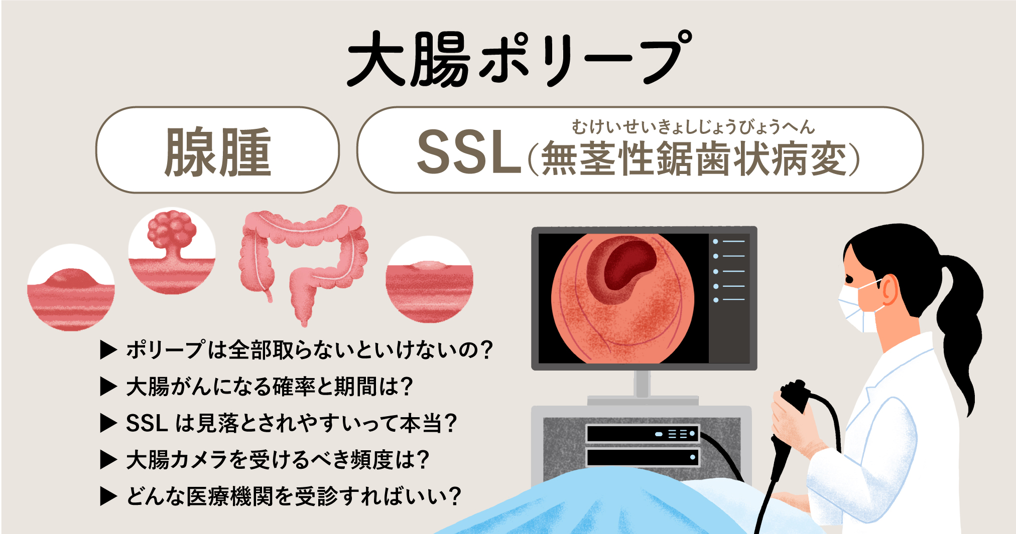 大腸 ポリープ 症状